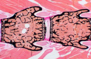 Vertebrae of a mouse